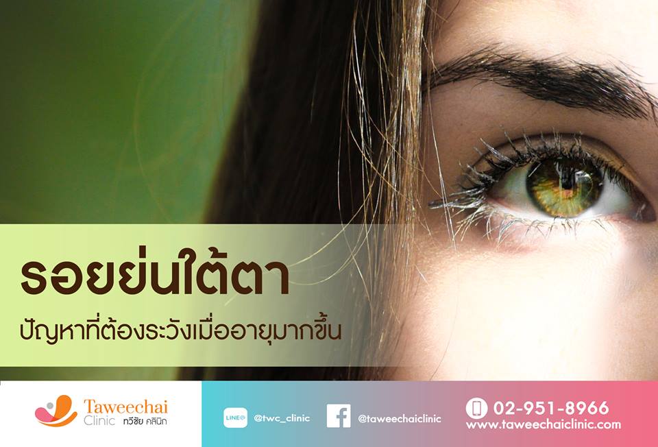 iอยย่นใต้ตา_TWC